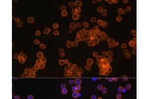 Immunofluorescence analysis of Raw264. (CD44 antibody)