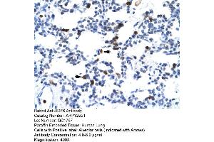 Human Lung (E2F6 antibody  (Middle Region))