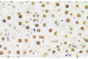 Immunohistochemistry of paraffin-embedded Rat liver using HDGF Polyclonal Antibody at dilution of 1:100 (40x lens). (HDGF antibody)