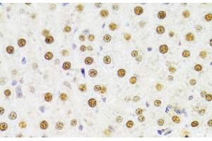Immunohistochemistry of paraffin-embedded Rat liver using HDGF Polyclonal Antibody at dilution of 1:100 (40x lens).