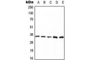 Western blot analysis of PPP2CA (pY307) expression in HEK293T EGF-treated (A), MCF7 (B), mouse brain (C), NIH3T3 (D), H9C2 EGF-treated (E) whole cell lysates. (PPP2CA antibody  (C-Term, pTyr307))