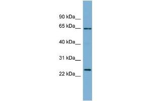 WB Suggested Anti-HOM-TES-103  Antibody Titration: 0. (IFFO1 antibody  (N-Term))