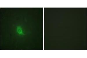 Immunofluorescence analysis of HuvEc cells, using SEPARASE (Phospho-Ser801) Antibody. (Separase antibody  (pSer801))