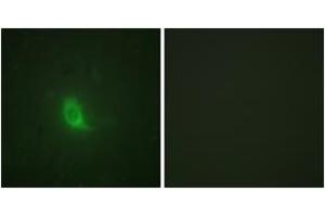 Immunofluorescence analysis of HuvEc cells, using SEPARASE (Phospho-Ser801) Antibody. (Separase antibody  (pSer801))