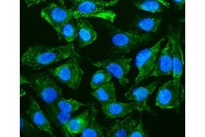 IF analysis of Caveolin-2/CAV2 using anti-Caveolin-2/CAV2 antibody (ABIN7601170). (Caveolin 2 antibody  (AA 3-162))