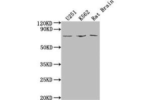 Western Blot Positive WB detected in: U251 whole cell lysate, K562 whole cell lysate, Rat Brain tissue All lanes: SGO1 antibody at 1:2000 Secondary Goat polyclonal to rabbit IgG at 1/50000 dilution Predicted band size: 65, 36, 34, 32, 30, 61, 25 kDa Observed band size: 65 kDa (Shugoshin antibody  (AA 260-439))