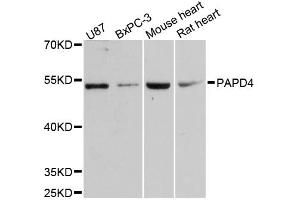 Western blot analysis of extracts of various cell lines, using PAPD4 antibody. (PAPD4 antibody)