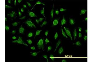 Immunofluorescence of monoclonal antibody to GABBR1 on HeLa cell. (GABBR1 antibody  (AA 52-151))