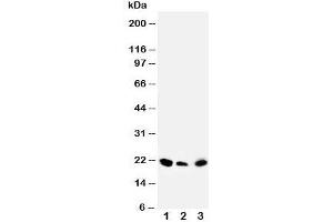 Western blot testing of DUSP3 antibody and Lane 1:  rat testis;  2: human SKOV;  3: (h) MM453 cell lysate (Dual Specificity Phosphatase 3 (DUSP3) (C-Term) antibody)