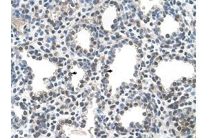 PPIB antibody was used for immunohistochemistry at a concentration of 4-8 ug/ml to stain Alveolar cells (arrows) in Human Lung. (PPIB antibody)