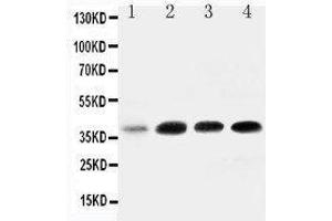 Anti-IGFBP3 antibody, Western blotting All lanes: Anti IGFBP3  at 0.
