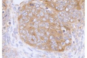Immunohistochemistry (IHC) image for anti-Eukaryotic Translation Initiation Factor 3 Subunit A (EIF3A) (AA 860-910) antibody (ABIN7453842)