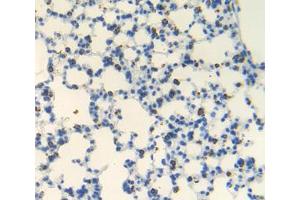 IHC-P analysis of lung tissue, with DAB staining. (Androgen Receptor antibody  (AA 156-310))
