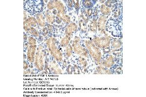 Rabbit Anti-PRMT1 Antibody  Paraffin Embedded Tissue: Human Kidney Cellular Data: Epithelial cells of renal tubule Antibody Concentration: 4. (PRMT1 antibody  (Middle Region))