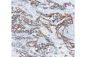 IHC analysis of Cytokeratin 20/Krt20 using anti-Cytokeratin 20/Krt20 antibody (ABIN7601133). (KRT20 antibody  (AA 29-431))