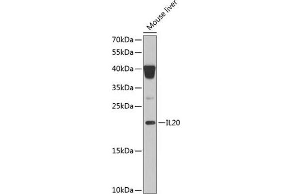 IL-20 抗体  (AA 25-176)