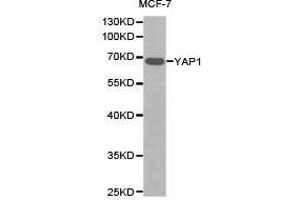 Western Blotting (WB) image for anti-Yes-Associated Protein 1 (YAP1) antibody (ABIN1875372)