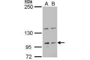 WB Image Laminin gamma 2 antibody detects Laminin gamma 2 protein by Western blot analysis. (LAMC2 antibody)