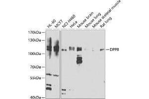 Western blot analysis of extracts of various cell lines, using DPP8 antibody (ABIN6130315, ABIN6139800, ABIN6139801 and ABIN6222925) at 1:1000 dilution. (DPP8 antibody  (AA 10-230))