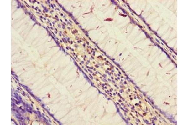STARD9 antibody  (AA 1960-2180)