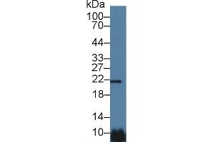 Detection of CSN1 in Human Hela cell lysate using Polyclonal Antibody to Casein Alpha (CSN1) (Casein alpha S1 antibody  (AA 16-185))