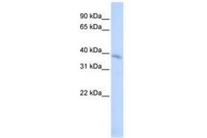 Image no. 1 for anti-Transmembrane Protein 82 (TMEM82) (AA 72-121) antibody (ABIN6740895) (TMEM82 antibody  (AA 72-121))