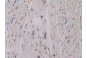 Immunohistochemistry (IHC) image for anti-Integrin beta 3 (ITGB3) (AA 134-376) antibody (ABIN7439249)