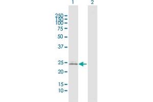 Western Blot analysis of IGKC expression in transfected 293T cell line by IGKC MaxPab polyclonal antibody. (IGKC antibody  (AA 1-234))