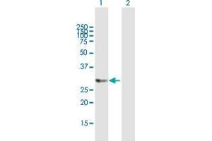 Western Blot analysis of HTATIP2 expression in transfected 293T cell line by HTATIP2 MaxPab polyclonal antibody.
