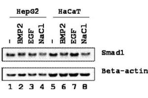 Image no. 1 for anti-SMAD, Mothers Against DPP Homolog 1 (SMAD1) (Ser206) antibody (ABIN401471) (SMAD1 antibody  (Ser206))