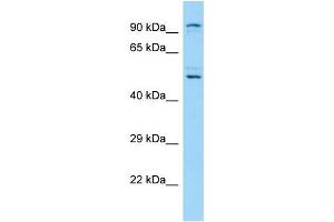 Western Blotting (WB) image for anti-Lysine (K)-Specific Demethylase 1B (KDM1B) (N-Term) antibody (ABIN2790414) (KDM1B antibody  (N-Term))