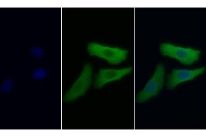 Detection of NSE in Human HepG2 cell using Monoclonal Antibody to Enolase, Neuron Specific (NSE) (ENO2/NSE antibody  (AA 2-285))