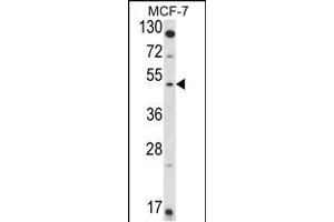 Western blot analysis of HSD11B2 Antibody (Center) (ABIN653721 and ABIN2843030) in MCF-7 cell line lysates (35 μg/lane). (HSD11B2 antibody  (AA 277-306))