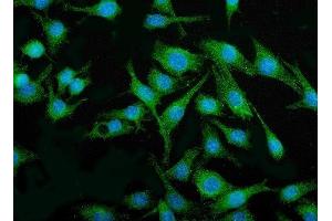 Figure 2 IF analysis of IRF3 using anti-IRF3 antibody (ABIN7599372). (IRF3 antibody  (AA 1-419))