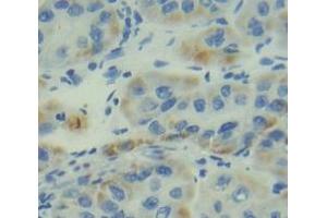 Figure. (ITGA5 antibody  (AA 895-1049))