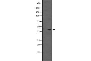 Western blot analysis of GPR86/GPR94 expression in Hela cell lysate,The lane on the left is treated with the antigen-specific peptide.