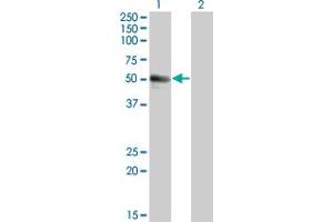 Western Blot analysis of SPN expression in transfected 293T cell line by SPN monoclonal antibody (M01), clone 3G8.