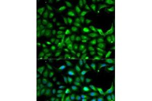 Immunofluorescence analysis of A-549 cells using IGF2 Polyclonal Antibody (IGF2 antibody)