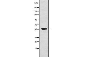 Western blot analysis NKX61 using HepG2 whole cell lysates (NKX6-1 antibody  (Internal Region))