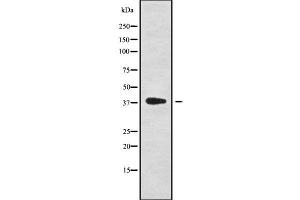 NKX6-1 antibody  (Internal Region)