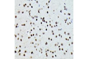 Immunohistochemistry of paraffin-embedded rat brain using FOSB Rabbit pAb (ABIN7267159) at dilution of 1:150 (40x lens). (FOSB antibody  (AA 1-100))