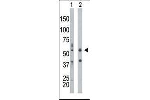 Western Blotting (WB) image for anti-Eukaryotic Translation Initiation Factor 2-alpha Kinase 2 (EIF2AK2) (AA 11-42), (N-Term) antibody (ABIN392778)