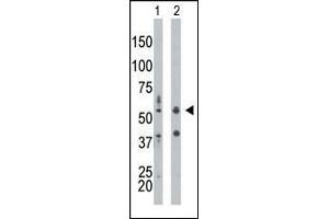 The anti-PRKR Pab (ABIN392778 and ABIN2837994) is used in Western blot to detect PRKR in mouse liver tissue lysate (Lane 1) and HepG2 cell lysate (Lane 2). (EIF2AK2 antibody  (N-Term))