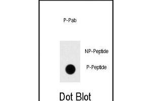 Dot blot analysis of anti-Phospho-Dnmt1-p Antibody (ABIN389917 and ABIN2839744) on nitrocellulose membrane. (DNMT1 antibody  (pSer154))