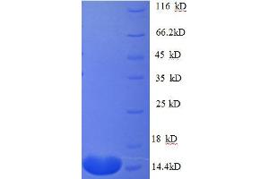 Connective Tissue Growth Factor (CTGF) (AA 253-349), (partial) protein (His tag) (CTGF Protein (AA 253-349, partial) (His tag))