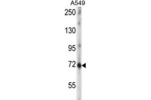 Western Blotting (WB) image for anti-Zinc Finger Protein 429 (ZNF429) antibody (ABIN5016641)