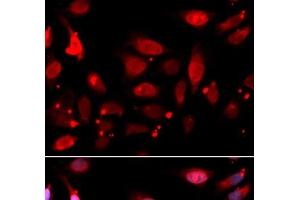 Immunofluorescence analysis of U2OS cells using RACGAP1 Polyclonal Antibody (RACGAP1 antibody)