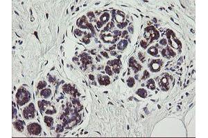 Immunohistochemical staining of paraffin-embedded Human breast tissue using anti-TPD52L3 mouse monoclonal antibody. (TPD52L3 antibody)