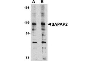 Western Blotting (WB) image for anti-Discs, Large (Drosophila) Homolog-Associated Protein 2 (DLGAP2) (Middle Region) antibody (ABIN1031077) (DLGAP2 antibody  (Middle Region))
