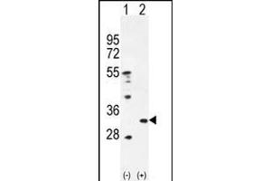 Western blot analysis of PRDX4 (arrow) using rabbit polyclonal PRDX4 Antibody (Center) (ABIN656035 and ABIN2845408). (Peroxiredoxin 4 antibody  (AA 82-110))